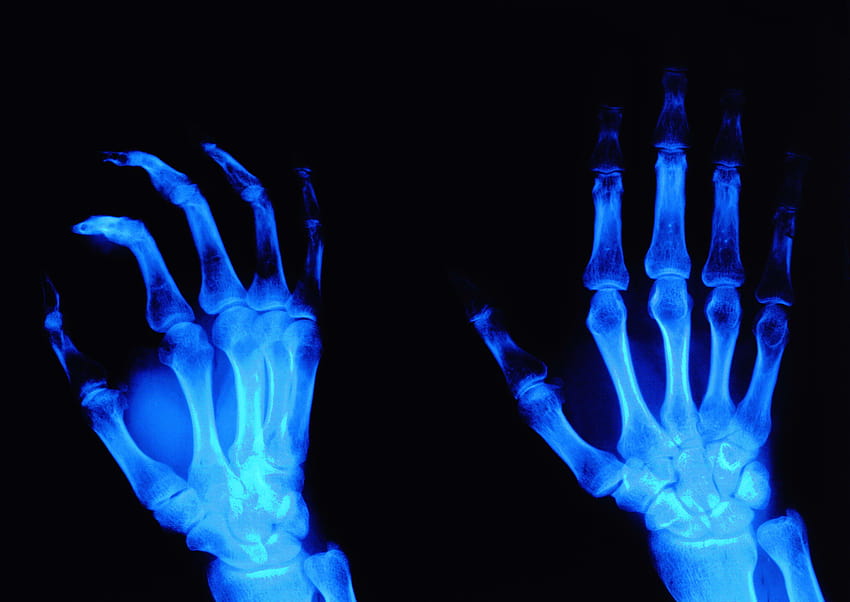 X Radiology HD Wallpaper Pxfuel