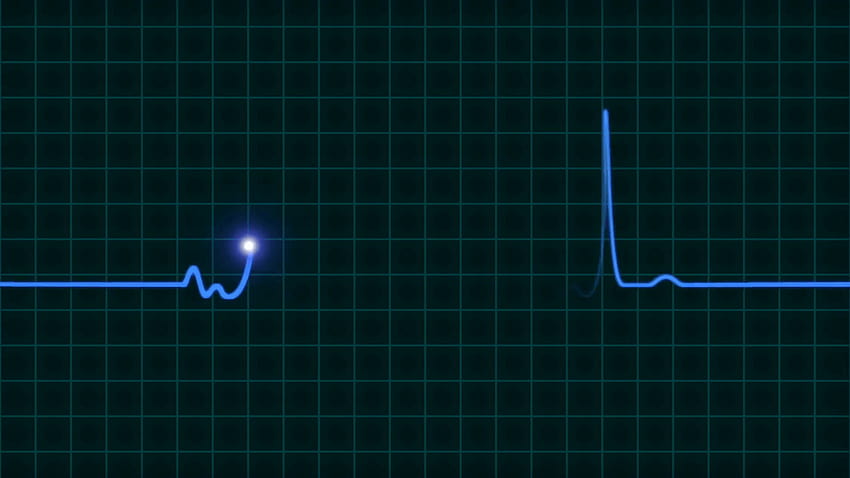 Um monitor de batimentos cardíacos EKG animado na linha de onda azul, batimento cardíaco papel de parede HD