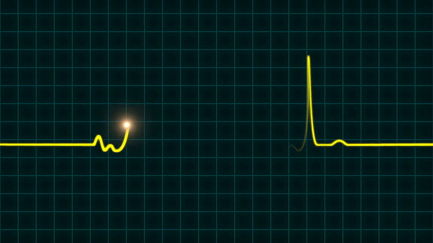 Ekg heartbeat monitor HD wallpapers | Pxfuel