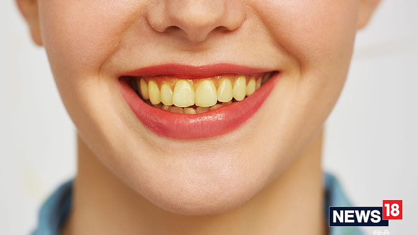 Jak pozbyć się żółtych zębów domowymi sposobami Tapeta HD
