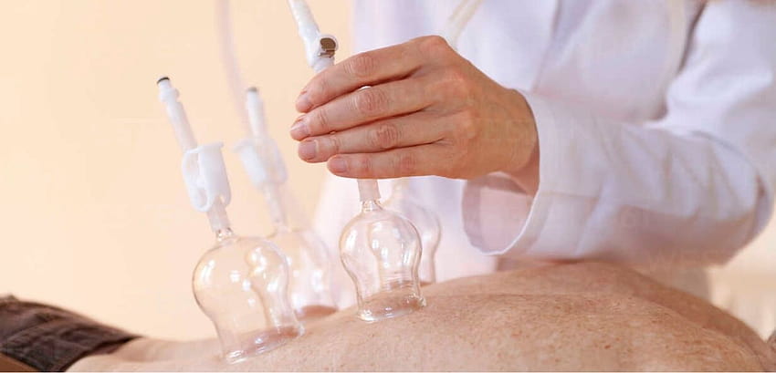 Hijama and Cupping, cupping therapy HD wallpaper