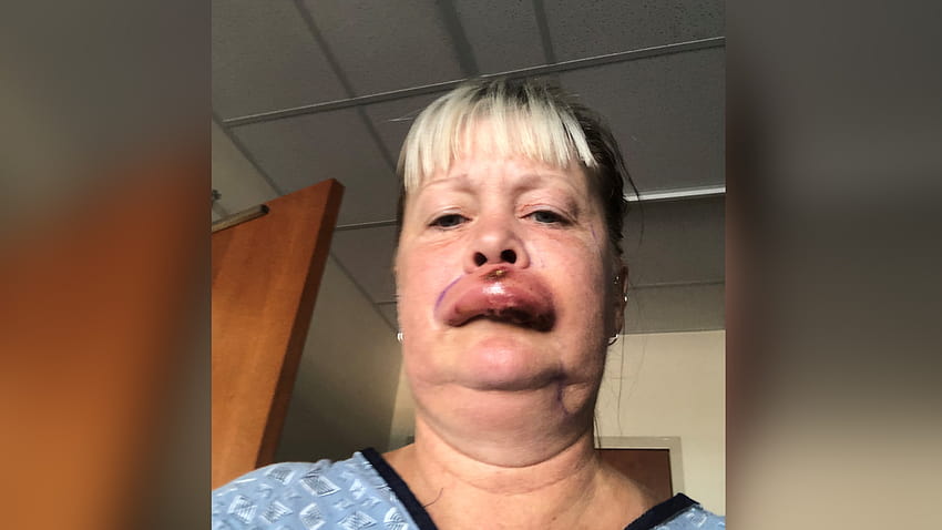 Mulher da Virgínia hospitalizada por picada de aranha marrom reclusa após andar de caiaque no rio Staunton papel de parede HD