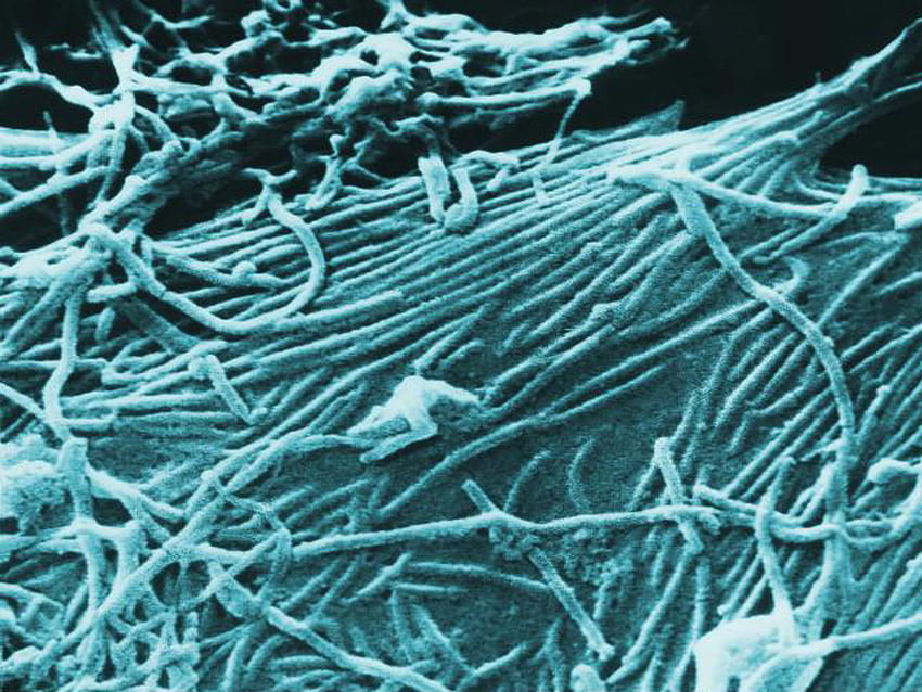 Fragen und Antworten: Ebola – Was Sie wissen müssen – Washington University School of Medicine in St. Louis HD-Hintergrundbild