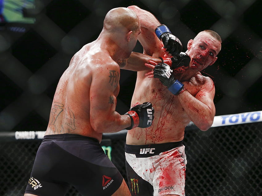 Rory MacDonald претърпя счупен нос и крак във войната на UFC 189 с Robbie Lawler HD тапет