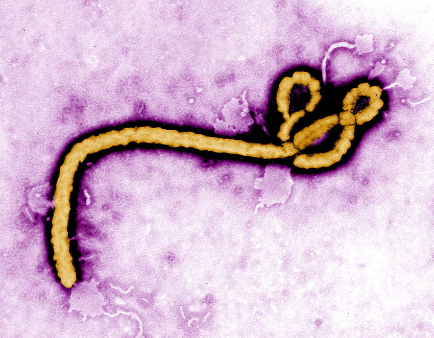 Ebola hemorrhagic fever virus ...pixnio, fatal virus HD wallpaper