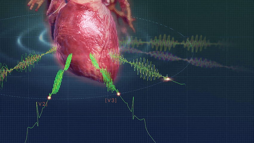 Heart Sciences MyoVista Wavelet ECG Technology Animation, electrocardiogram HD wallpaper