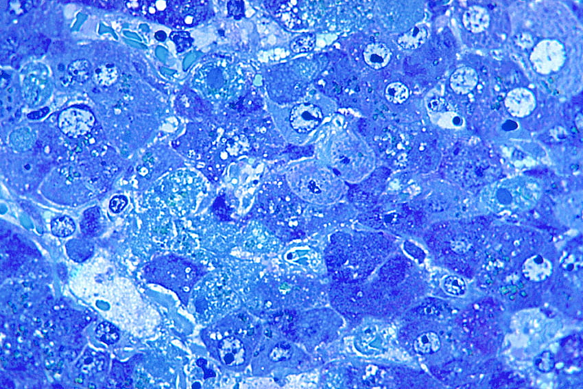 : micrograph, shows, hepatitis, lassa, virus HD wallpaper