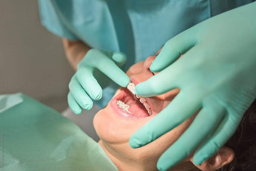Détail d'un dentiste fixant des appareils dentaires au patient par, dentisterie Fond d'écran HD
