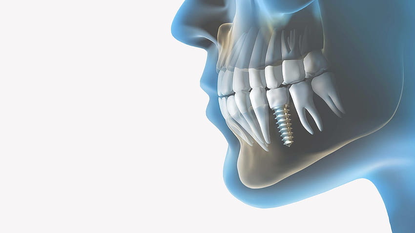 Odontología fondo de pantalla | Pxfuel