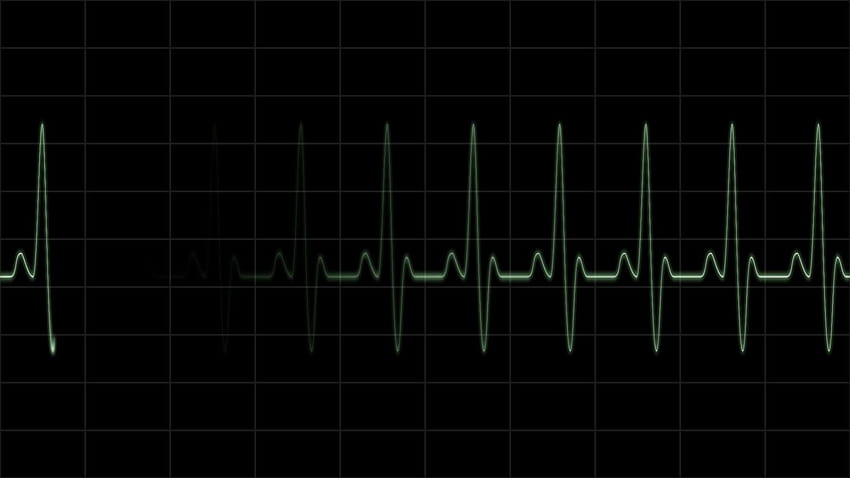 Iphone Heart Ecg, cardiology HD wallpaper