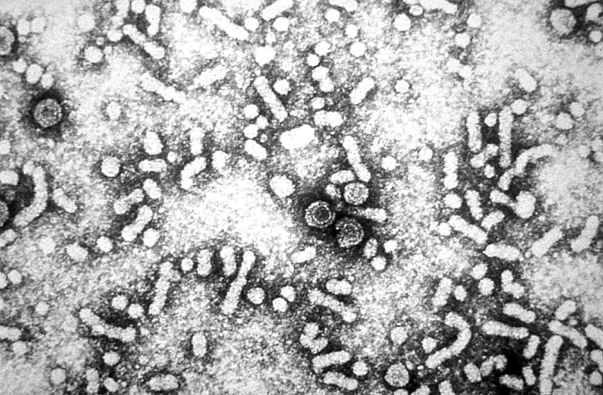 : electron micrograph, presence, hepatitis, virus, dane HD wallpaper