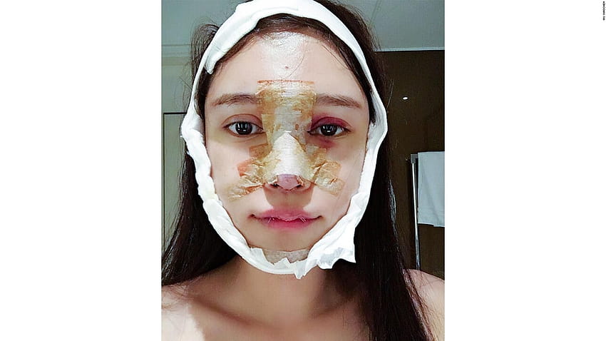 App di chirurgia estetica in Cina: scorri per acquistare un nuovo volto, ragazza estetica cinese Sfondo HD