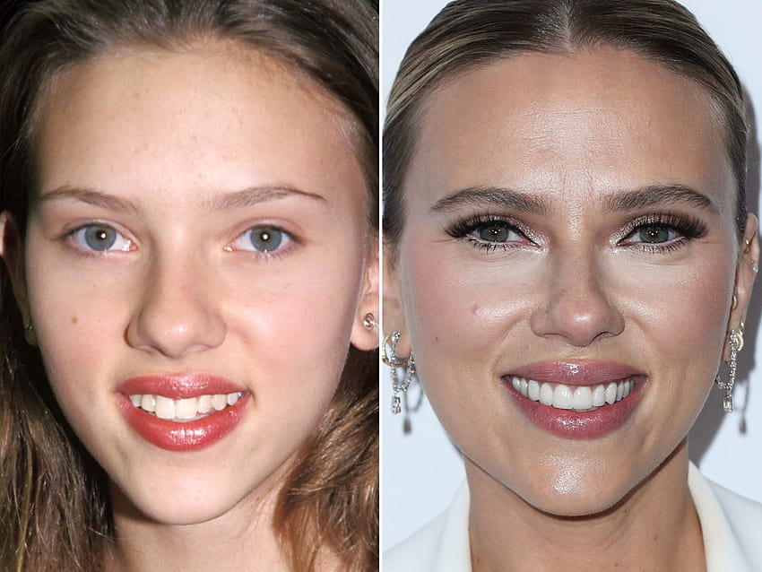 Scarlett Johansson Antes e Depois: De 1997 a 2021 papel de parede HD