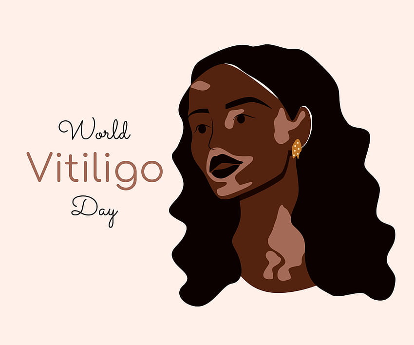 Genç Afrikalı Amerikalı kadın vitiligo ile yaşıyor. Farklı güzellik, kendini sevme ve cilt hastalığı konsepti. Dünya vitiligo günü. Bej arka planlar üzerinde izole edilmiş düz vektör illüstrasyonu 6006807 Vektör Sanatı, Vecteezy HD duvar kağıdı