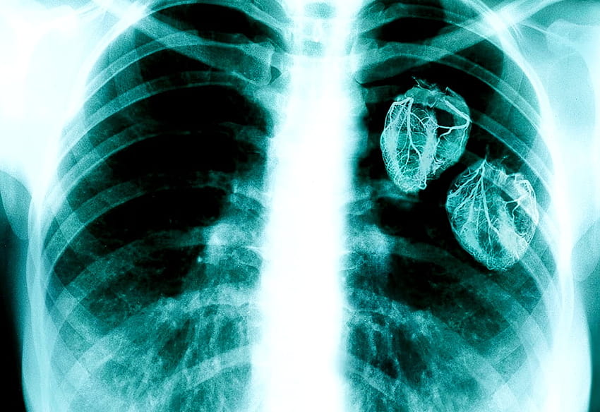 Medical radiography HD wallpaper
