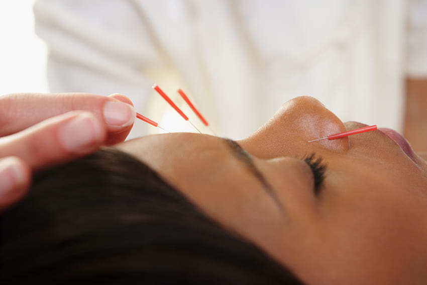 침술이 한 여성의 여드름을 치료한 방법 HD 월페이퍼