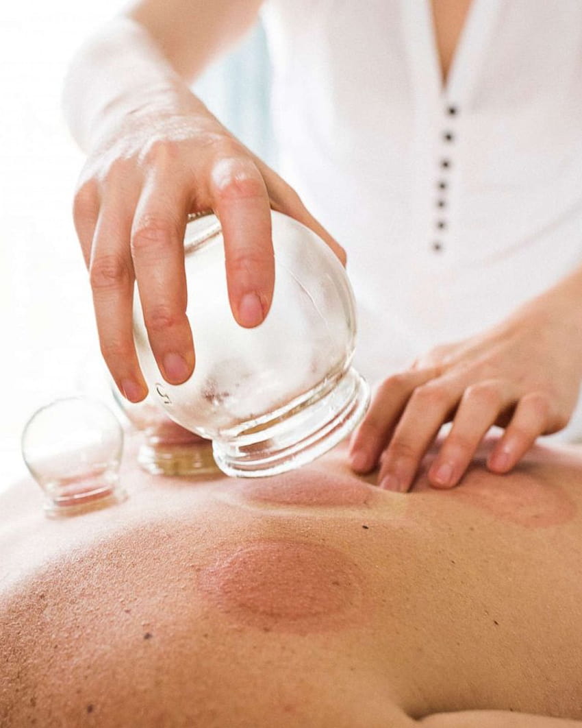 Everything you need to know about cupping, a traditional Chinese medical technique, cupping therapy HD phone wallpaper