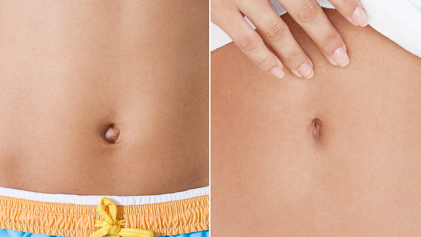 Belly Button Plastic Surgery Turns Outties Into Innies HD wallpaper
