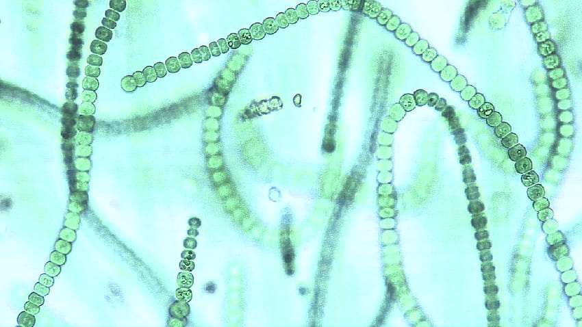 Mikroskopische Ansicht von Algenketten, diese Cyanobakterien, Microcystis sp., sind eine Art Blaualgen, die in Süßwasser leben. Lagervideo, Cyanophyta HD-Hintergrundbild