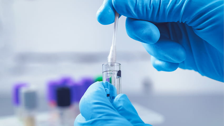 UCLA erhält FDA-Zulassung für Coronavirus-Testtechnologie, die Tausende von Proben gleichzeitig verarbeiten kann, PCR HD-Hintergrundbild