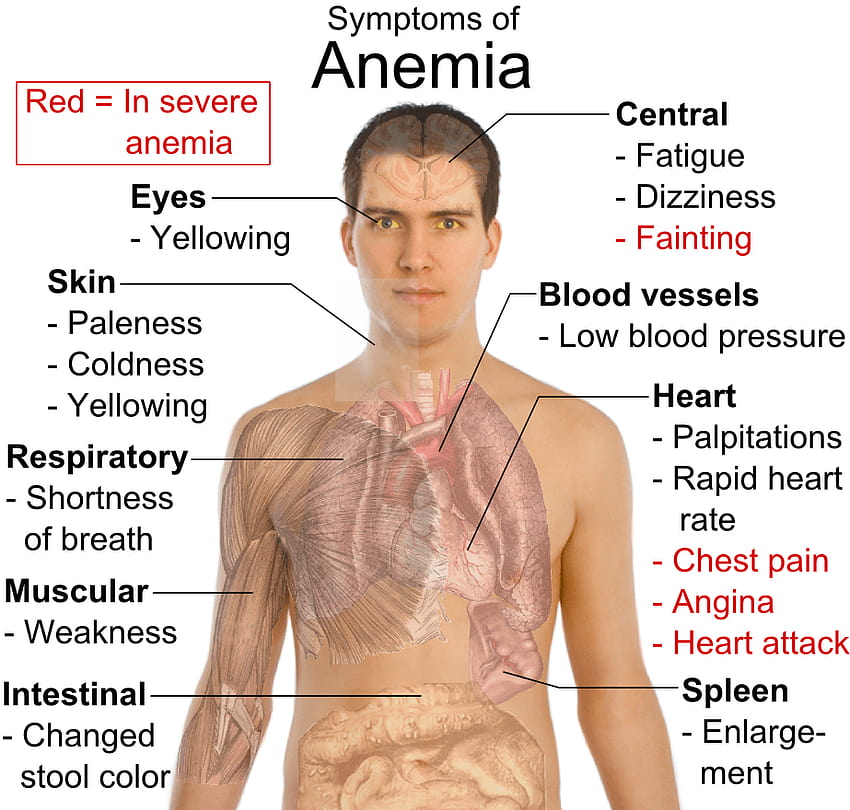 iron deficiency anemia symptoms HD wallpaper