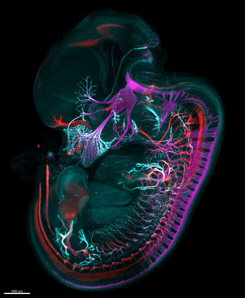 of Distinction 2018 Concurso de micrografía Embrión de ratón fondo de pantalla del teléfono