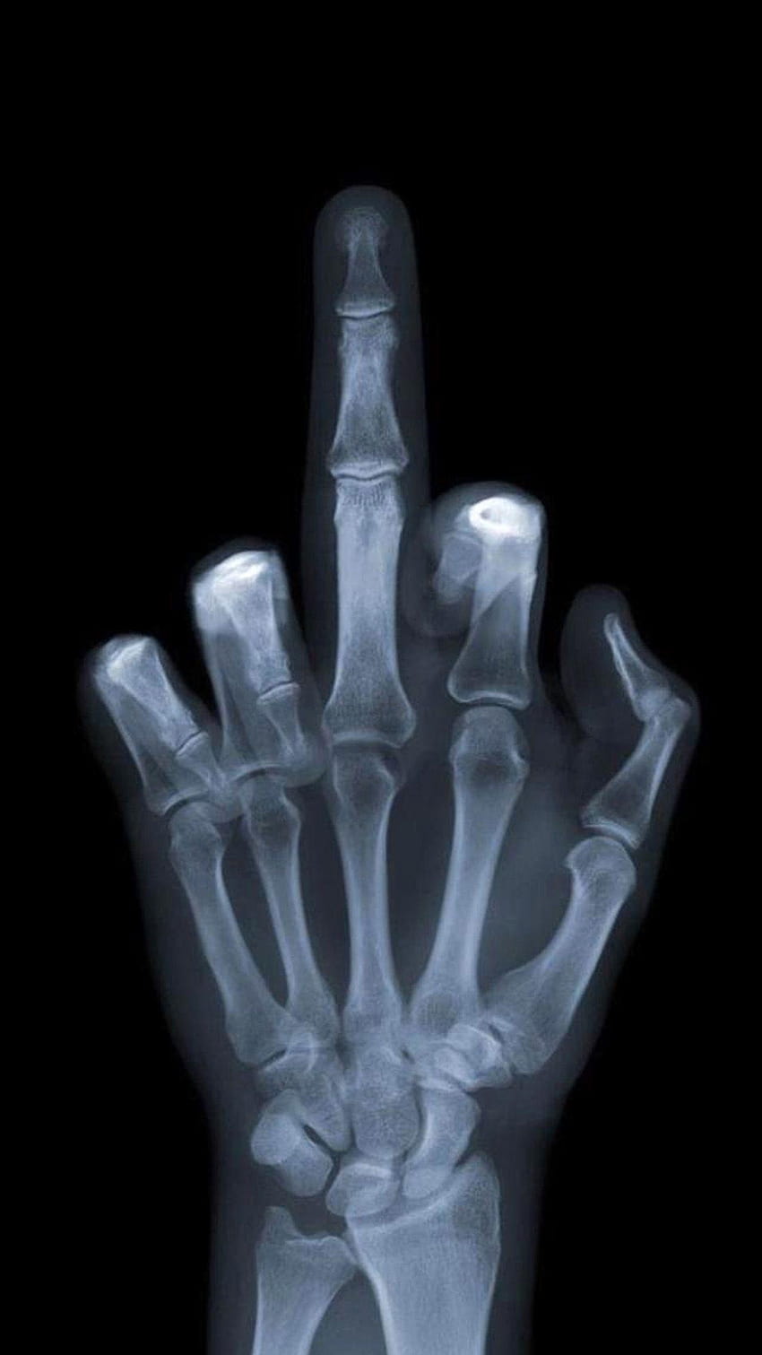 Среден пръст X, радиология HD тапет за телефон