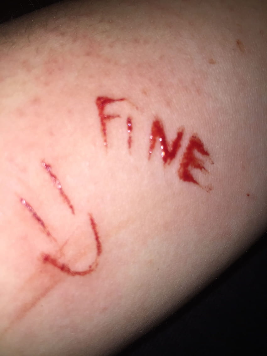 Sangue postado por Zoey Simpson fofa, mão cortada Papel de parede de celular HD