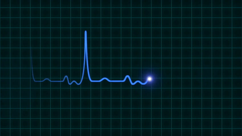Ekg heartbeat monitor HD wallpapers | Pxfuel
