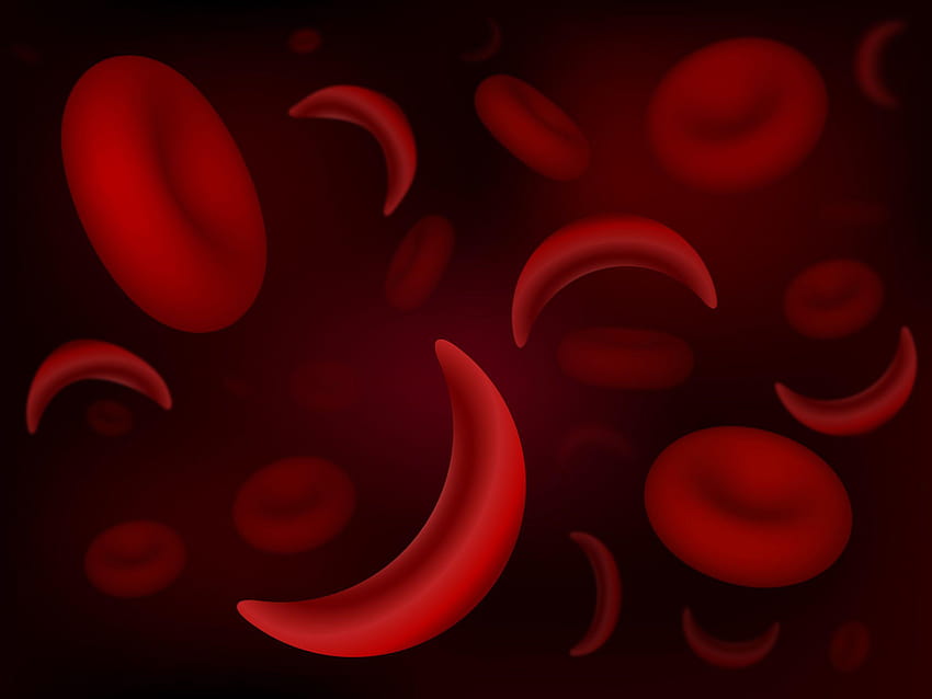 Sickle Cell Disease Overview HD wallpaper