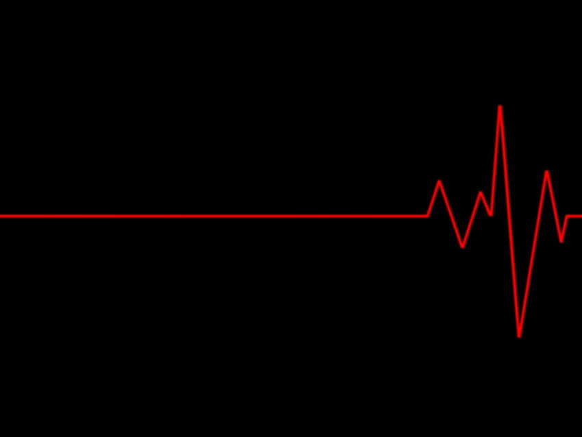 EKG, Ekg HD-Hintergrundbild