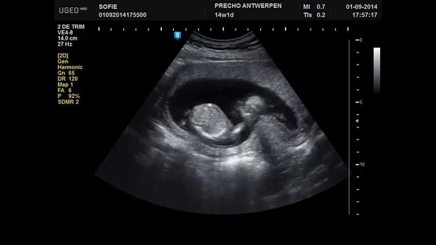 2D ултразвук на 14 седмици бременност: активно бебе HD тапет