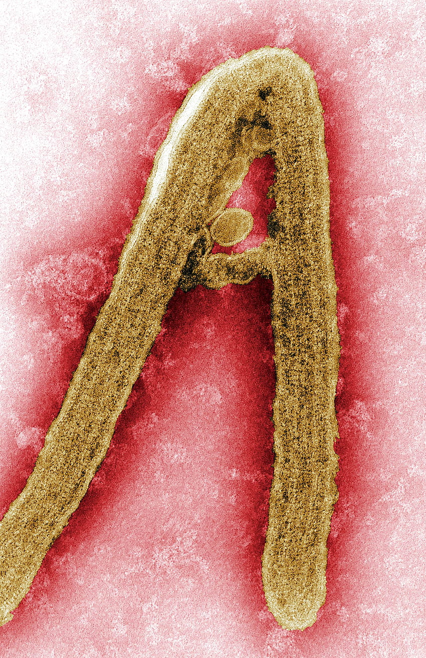 Ebola hemorrhagic fever virus ...pixnio, fatal virus HD phone wallpaper