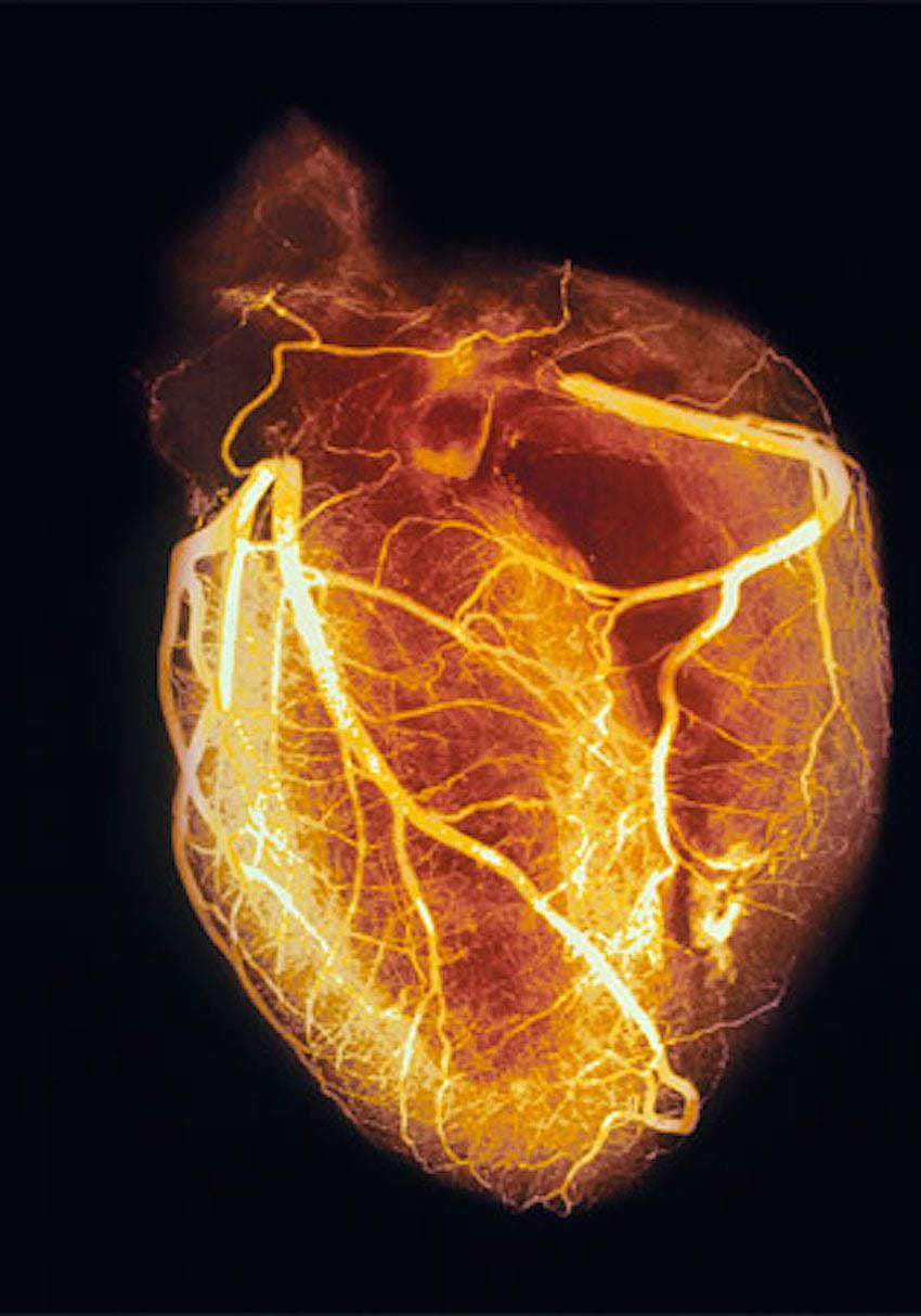 Das Akzeptieren einer Herzinsuffizienz kann Patienten helfen, den Rest ihres Lebens zu genießen, Kardiologie HD-Handy-Hintergrundbild