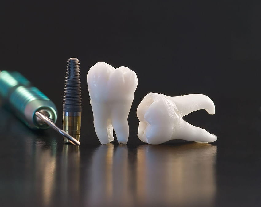 45 Висококачествена стоматология, зъболекар HD тапет