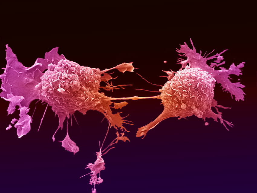 Cancer cells 1080P 2K 4K 5K HD wallpapers free download  Wallpaper Flare