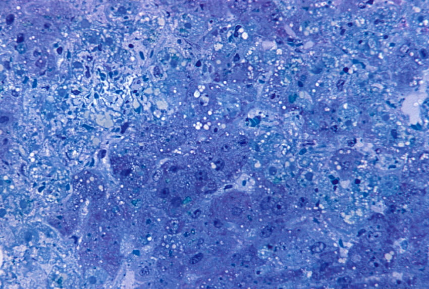 : micrograph, hepatitis, lassa, virus HD wallpaper