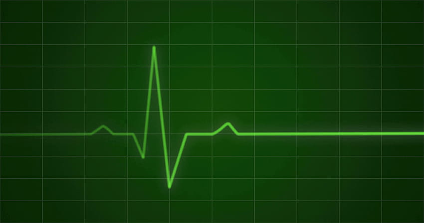 Monitor de batimentos cardíacos EKG, animação Motion Backgrounds, ecg papel de parede HD